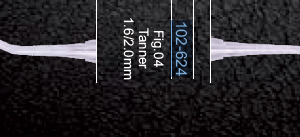 Tanner fig4 1.6/2.0mm solid handle